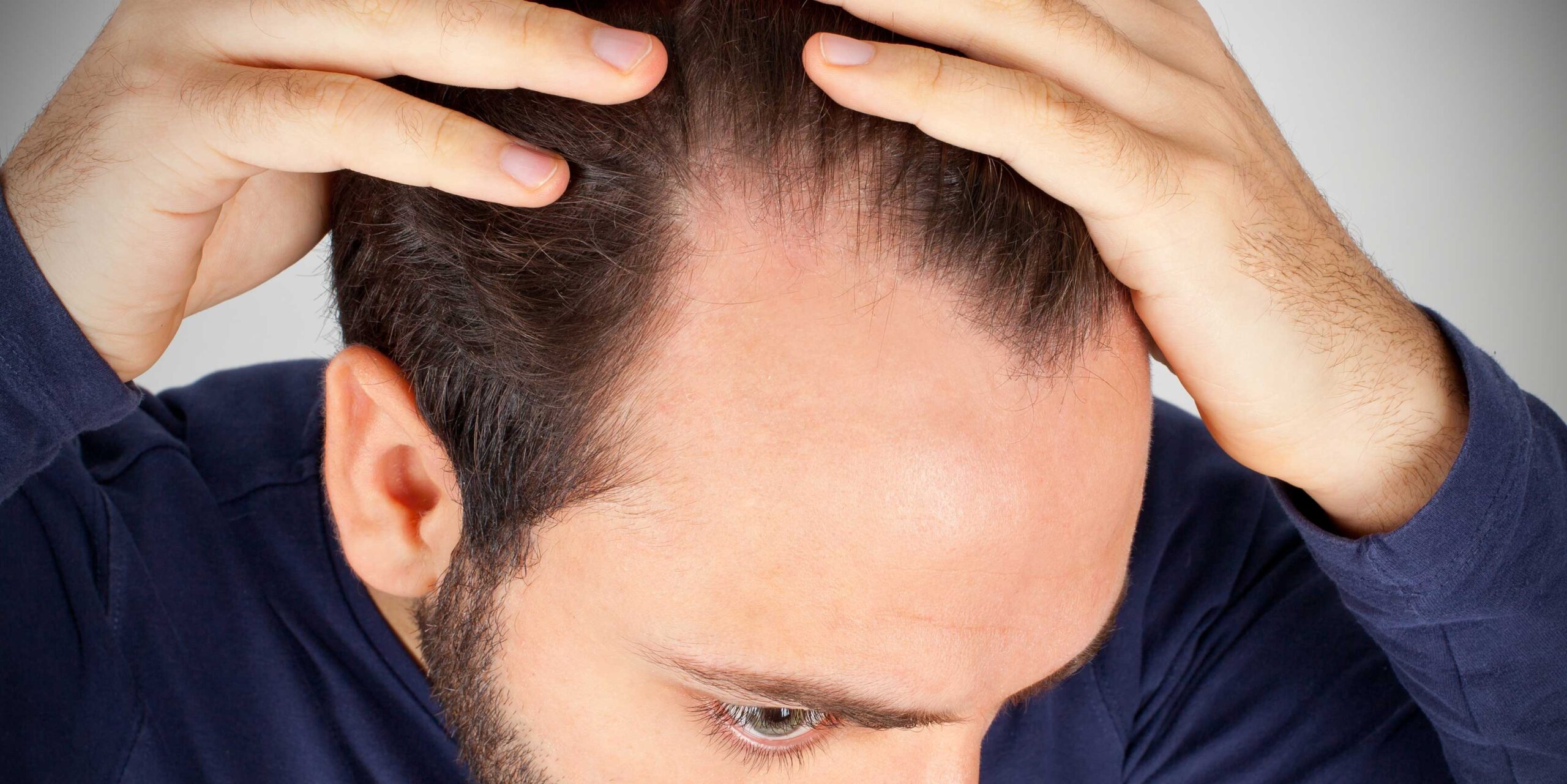 Укрепление волос мужчинам