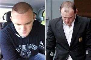 transplante de pelo de Rooney