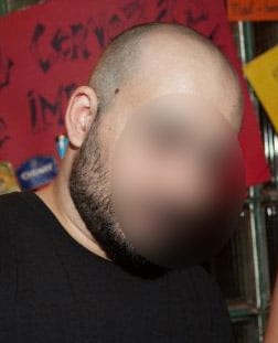celulas-madre-antes