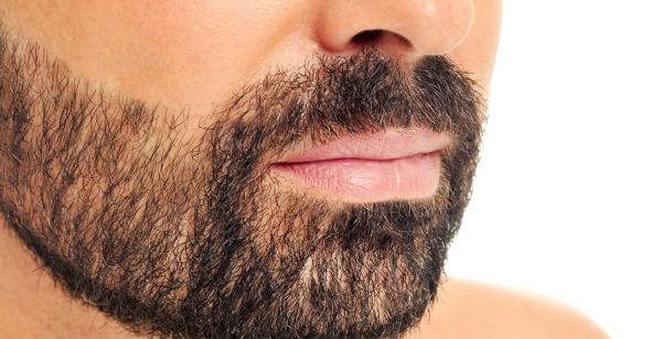 implante de barba