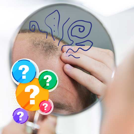 Hombre mirándose al espejo por causas-de-la-alopecia