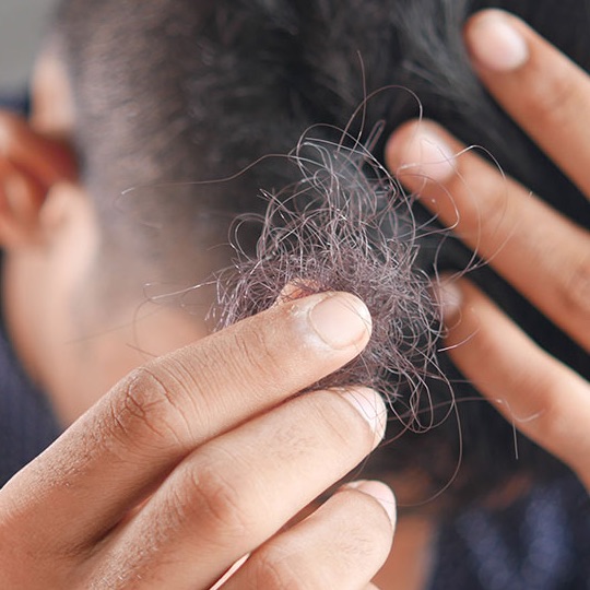 Detalle de pelo caído de un hombre cogido con los dedos.