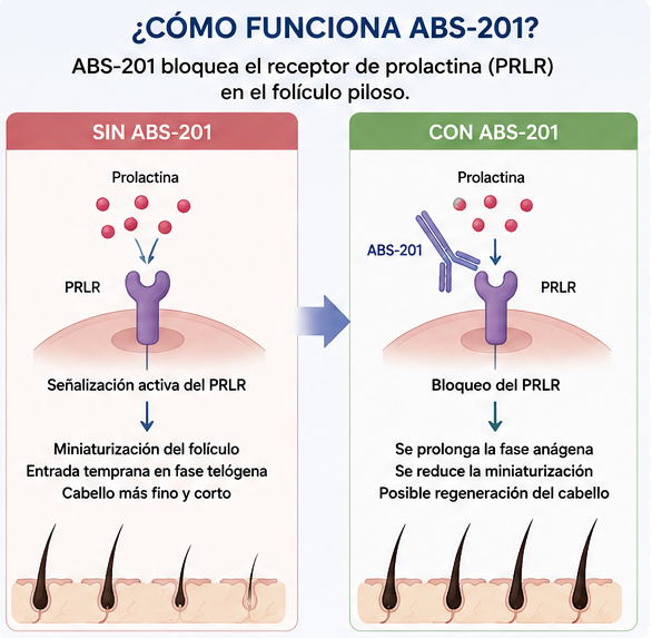 Cómo funciona ABS-201