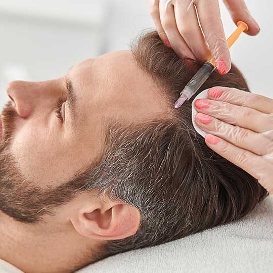 Tratamientos para frenar la caída del pelo Implantes capilares